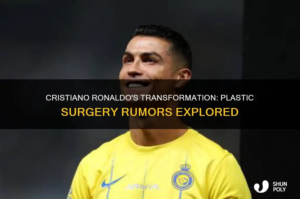 did ronaldo have plastic surgery