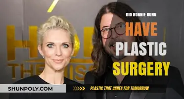Did Ronnie Dunn Undergo Plastic Surgery? Unveiling the Truth