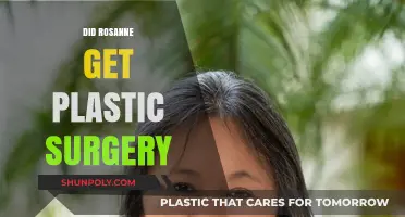 Rosanne's Transformation: Unveiling the Truth About Her Plastic Surgery