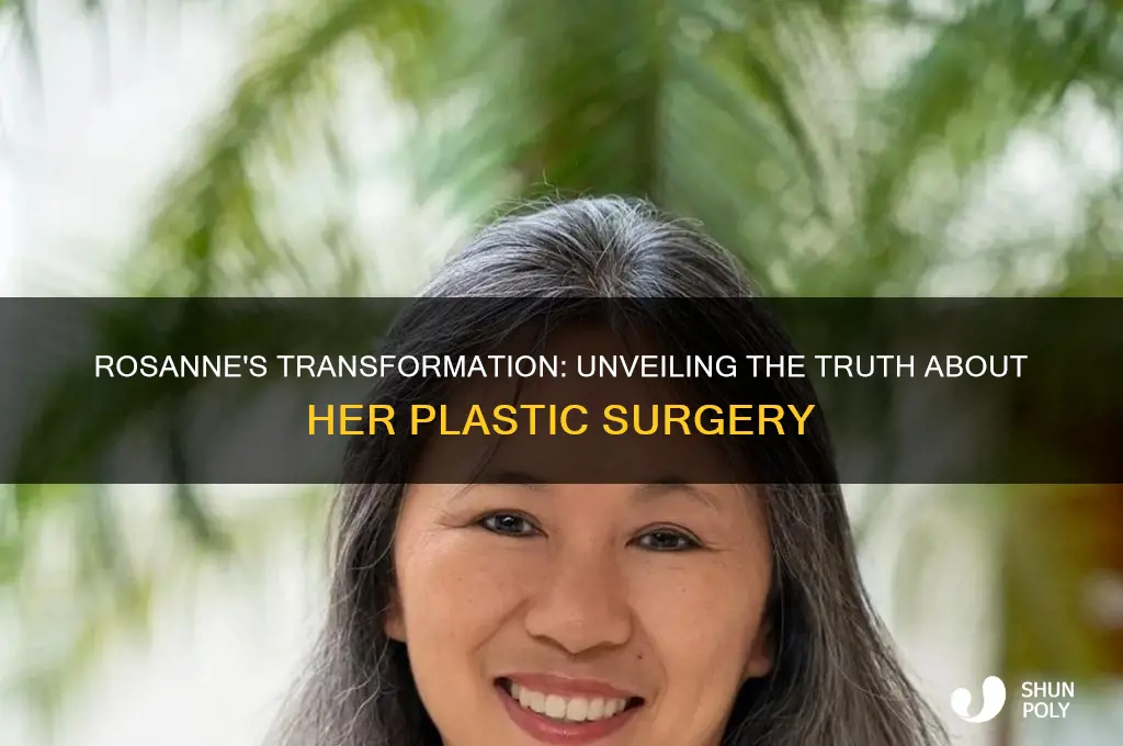 did rosanne get plastic surgery