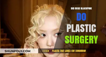 Rose Blackpink Plastic Surgery: Fact-Checking Rumors and Speculations