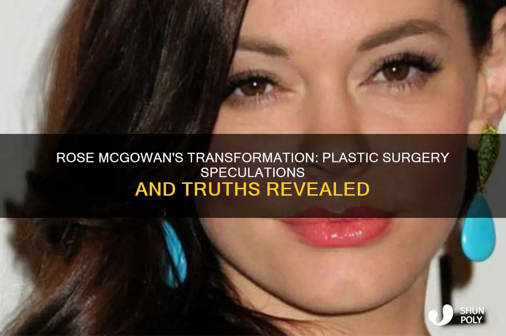 did rose mcgowan get plastic surgery