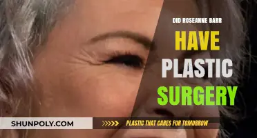 Roseanne Barr's Transformation: Plastic Surgery Rumors and Reality Revealed
