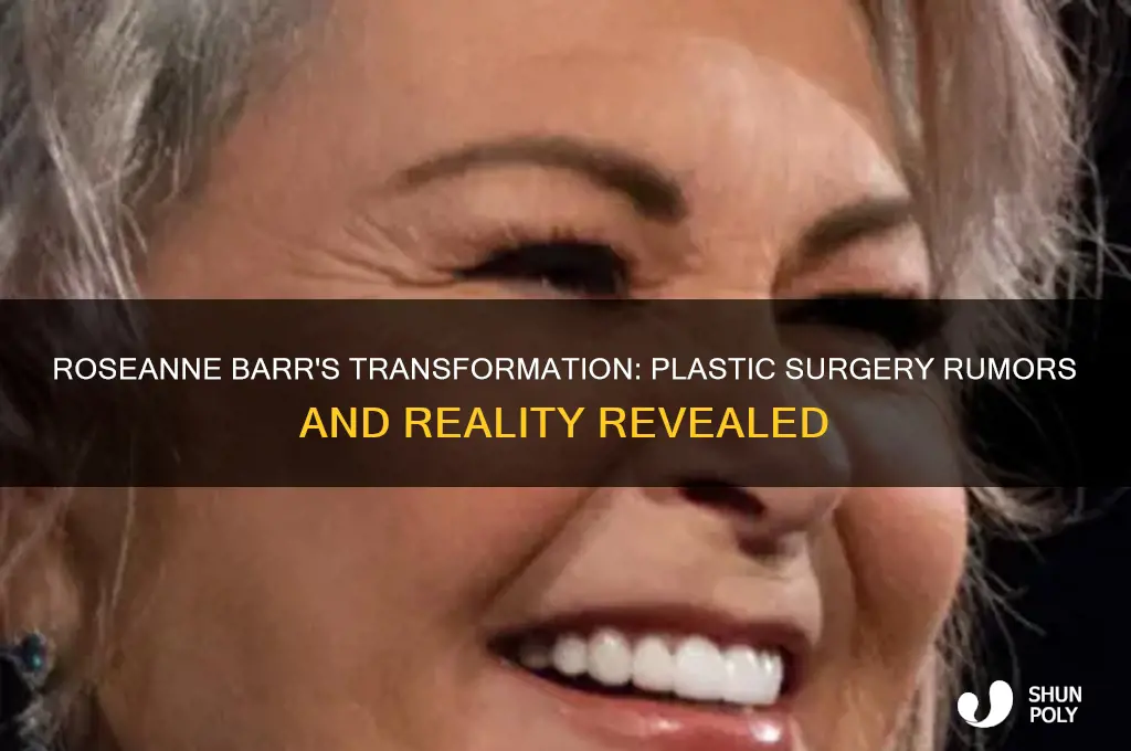 did roseanne barr have plastic surgery