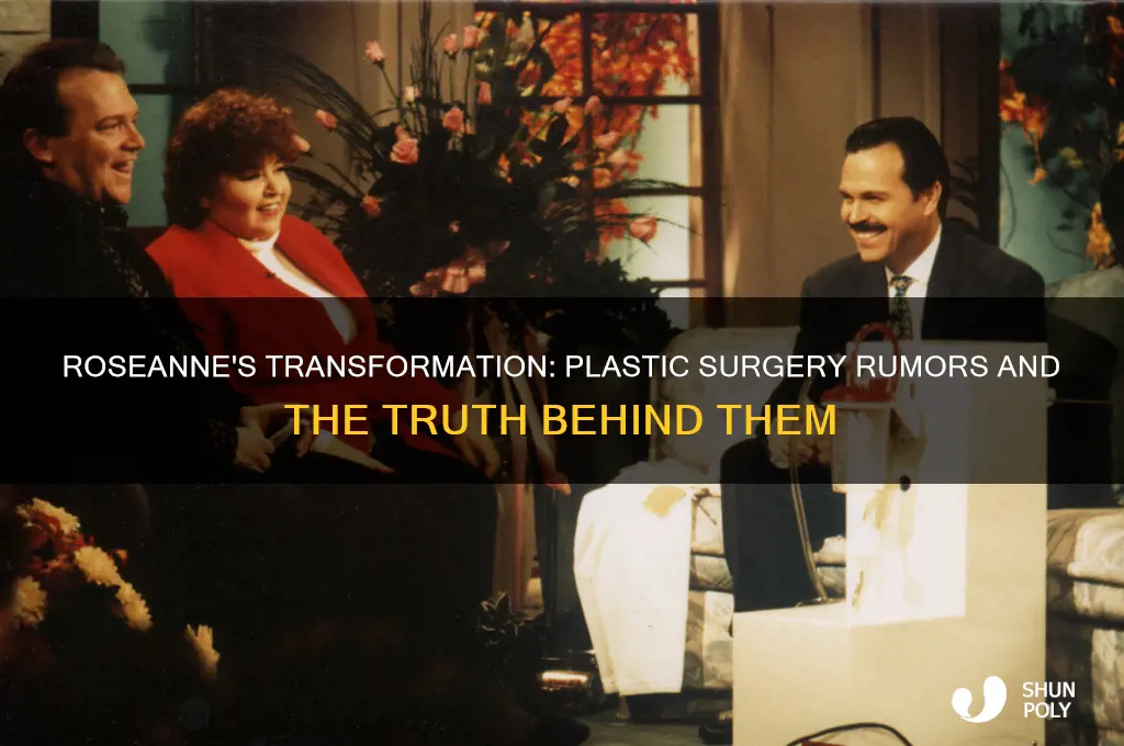did roseanne get plastic surgery