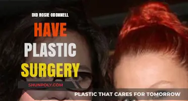 Rosie O'Donnell's Transformation: Plastic Surgery Speculations and Truths