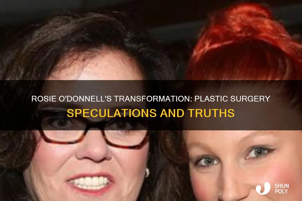 did rosie odonnell have plastic surgery