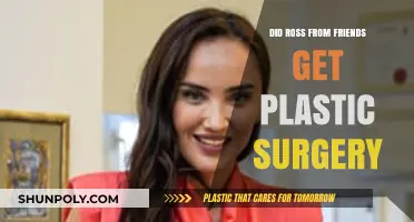 Did Ross from Friends Undergo Plastic Surgery? The Truth Revealed