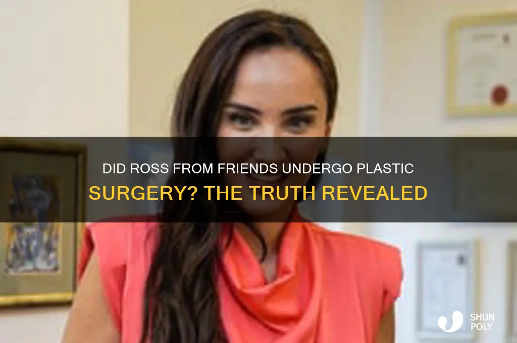 did ross from friends get plastic surgery