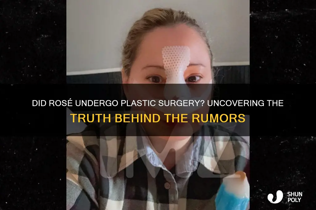 did rosé get plastic surgery