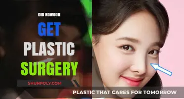 Rowoon Plastic Surgery: Unraveling the Truth Behind His Transformation