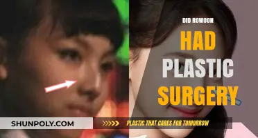 Rowoon Plastic Surgery: Unveiling the Truth Behind His Transformation