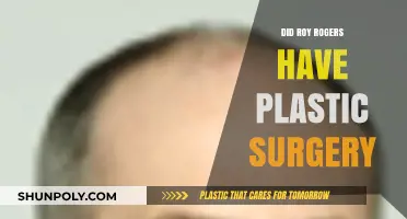 Roy Rogers' Plastic Surgery: Fact or Fiction?