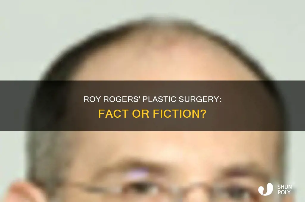 did roy rogers have plastic surgery