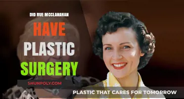 Rue McClanahan's Transformation: Plastic Surgery Speculations and Truths