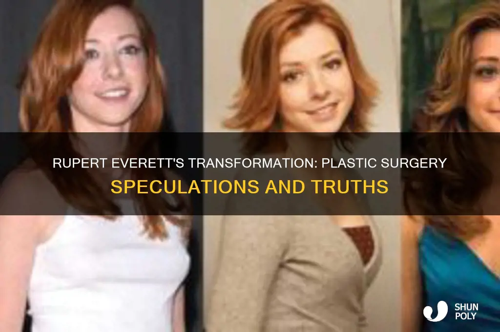did rupert everet have plastic surgery
