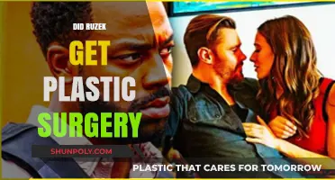 Did Ruzek Undergo Plastic Surgery? Unraveling the Transformation Rumors