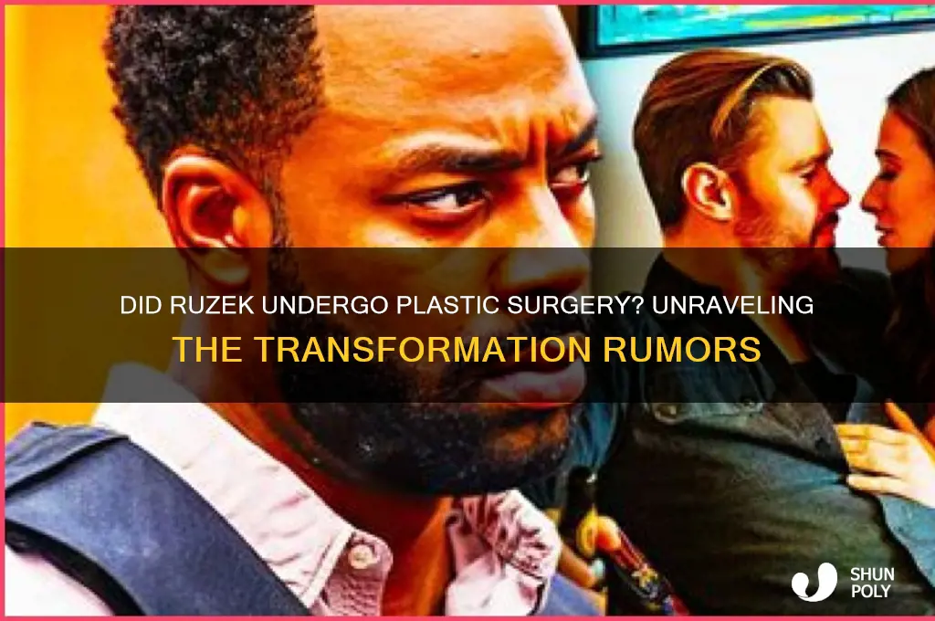 did ruzek get plastic surgery