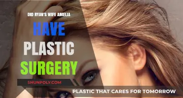 Amelia's Transformation: Plastic Surgery Speculations Surrounding Ryan's Wife