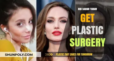 Sahar Tabar's Transformation: Plastic Surgery or Digital Illusion?
