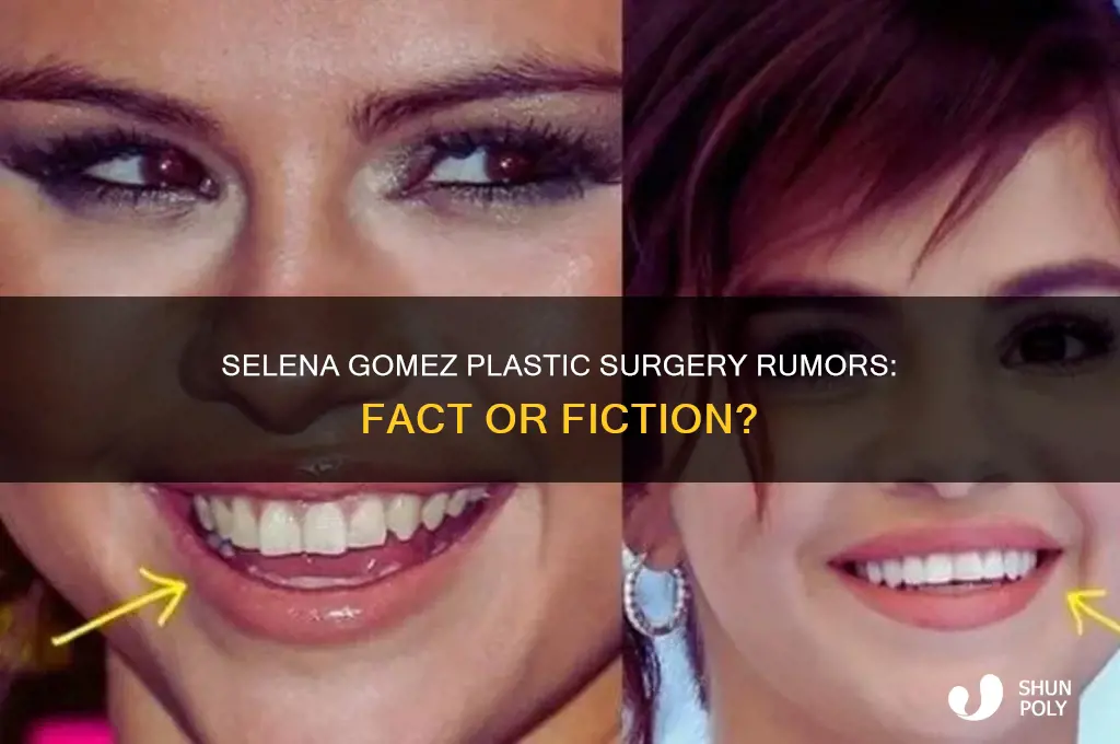 did salena gomez get plastic surgery