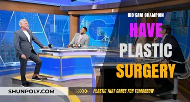 Sam Champion Plastic Surgery: Fact-Checking the Rumors and Speculations