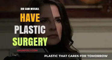 Did Sam McCall Undergo Plastic Surgery? Uncovering the Truth