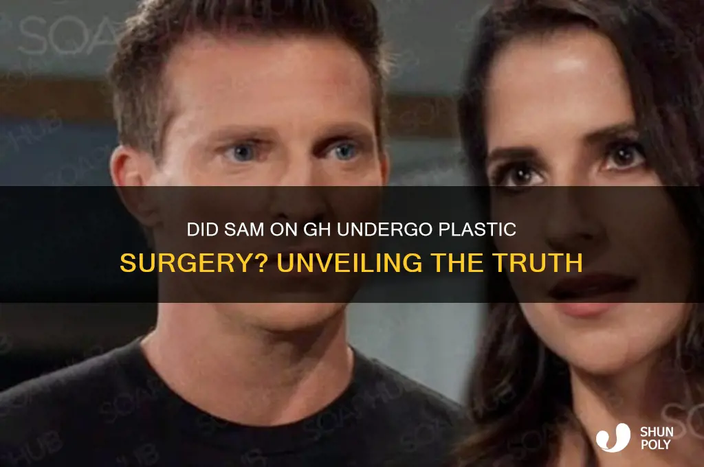 did sam on gh have plastic surgery