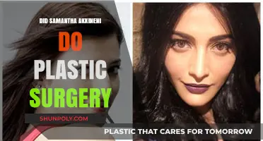 Samantha Akkineni's Transformation: Plastic Surgery Rumors Explored and Debunked