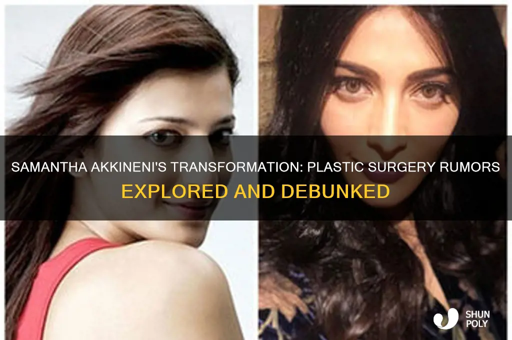 did samantha akkineni do plastic surgery