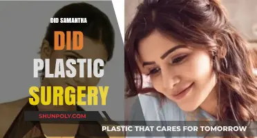 Samantha's Transformation: Unveiling the Truth About Her Plastic Surgery