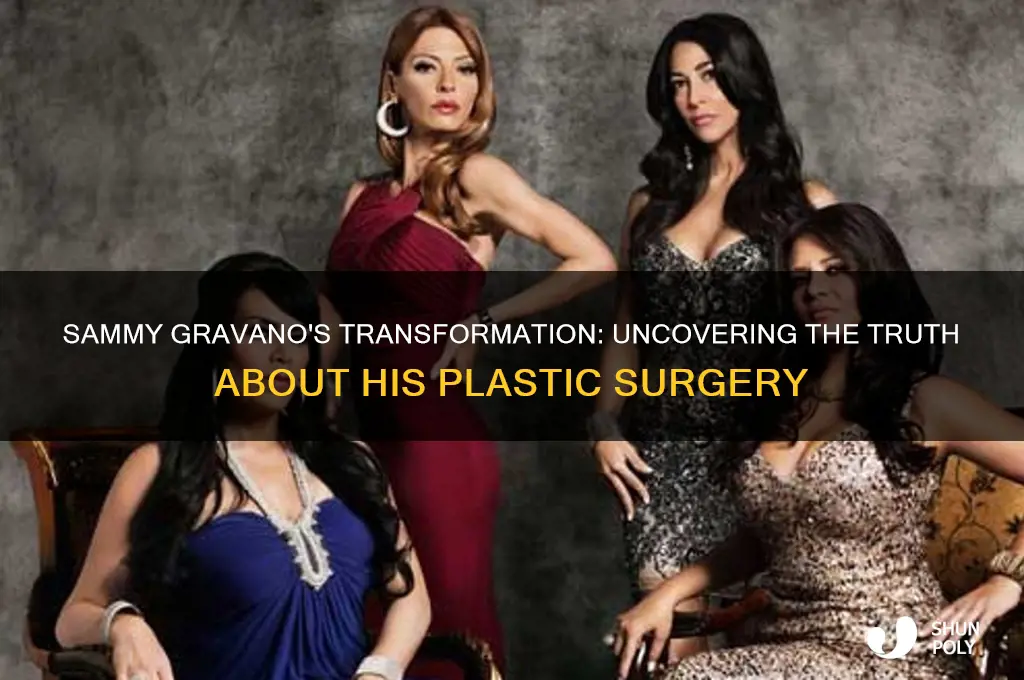 did sammy gravano have plastic surgery
