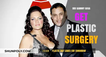 Did Sammy Sosa Undergo Plastic Surgery? Unraveling the Transformation Truth