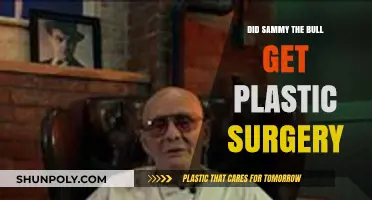 Did Sammy the Bull Undergo Plastic Surgery? Unveiling the Truth