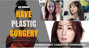 Did Sandara Park Undergo Plastic Surgery? Unveiling the Truth