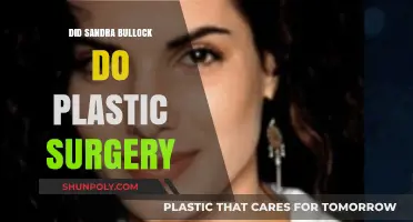 Sandra Bullock's Transformation: Plastic Surgery Rumors and Reality Revealed