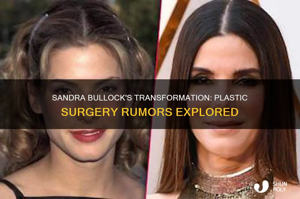 did sandra bullock get plastic surger
