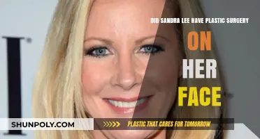 Sandra Lee's Facial Transformation: Plastic Surgery Speculations Explored
