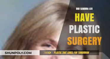 Sandra Lee's Transformation: Unveiling the Truth About Plastic Surgery