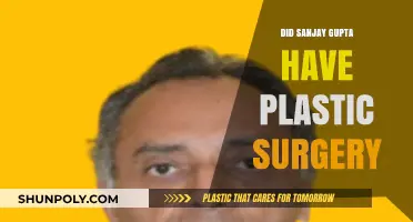 Sanjay Gupta's Transformation: Plastic Surgery Speculations and Facts Revealed