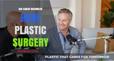 Sarah Baeumler Plastic Surgery: Fact-Checking the Transformation Rumors