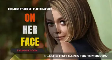 Sarah Hyland's Facial Transformation: Plastic Surgery Speculations Explored