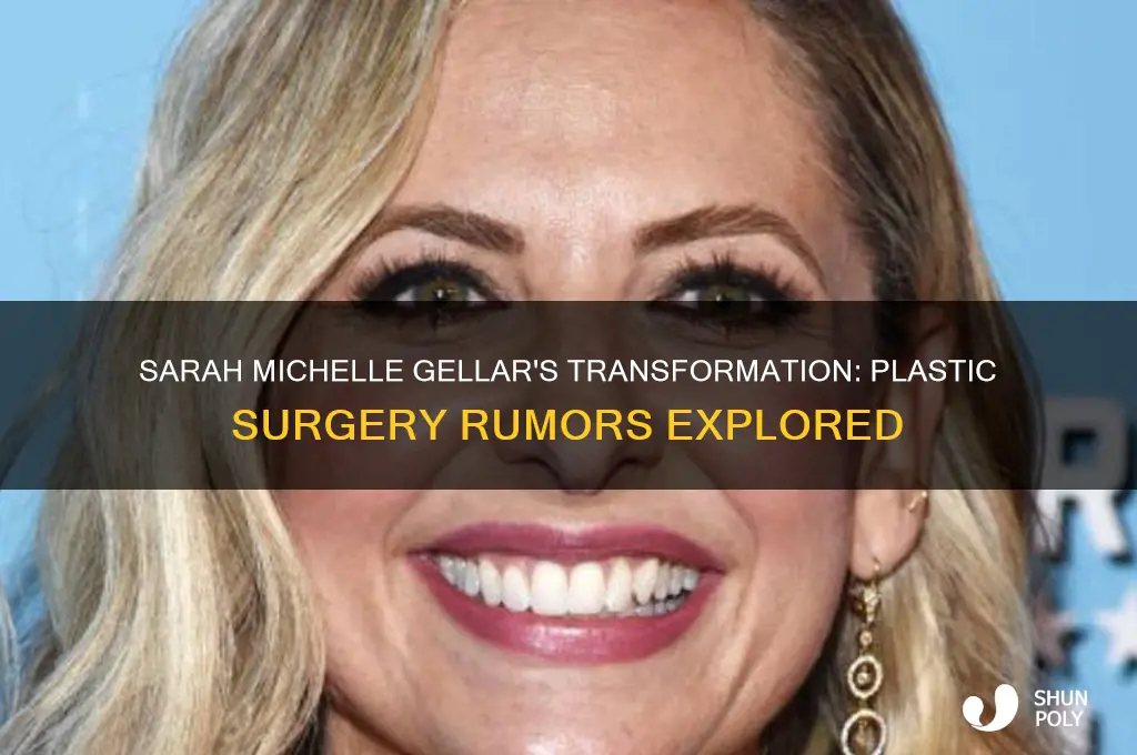 did sarah michelle gellar get plastic surgery
