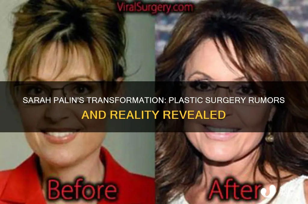 did sarah palin get plastic surgery