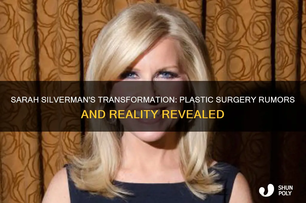 did sarah silverman have plastic surgery
