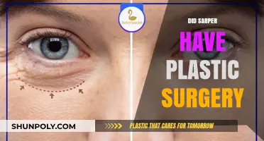 Did Sarper Undergo Plastic Surgery? Unveiling the Truth Behind the Rumors