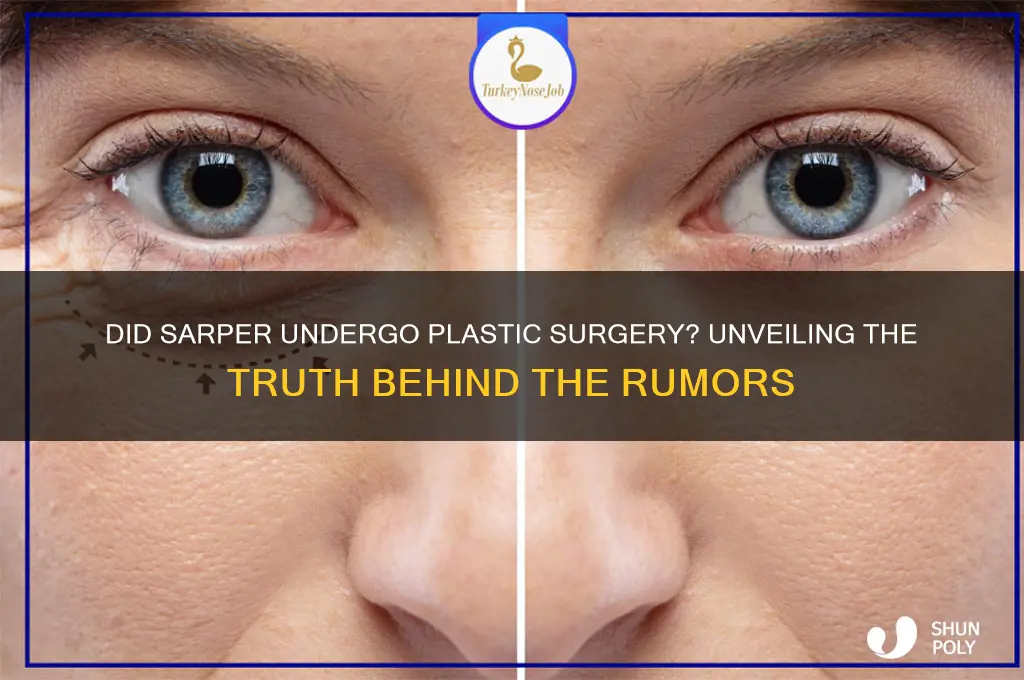 did sarper have plastic surgery