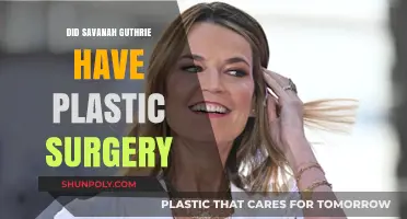 Savanah Guthrie's Transformation: Plastic Surgery Rumors Explored