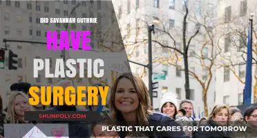 Savannah Guthrie's Transformation: Plastic Surgery Rumors Explored and Debunked