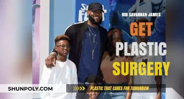 Savannah James Plastic Surgery: Fact-Checking the Rumors and Speculations